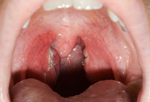 Throat