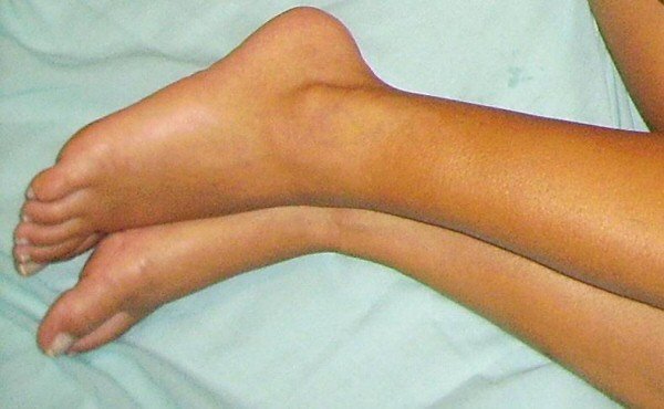 feet1