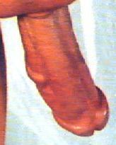 GCL